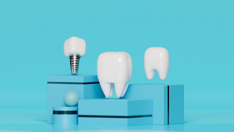 mini impianti dentali cosa sono come funzionano